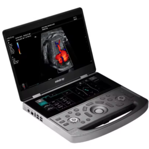 Ultrasound Doppler Device