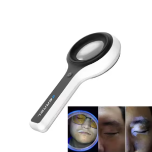 UV Skin Analyzer
